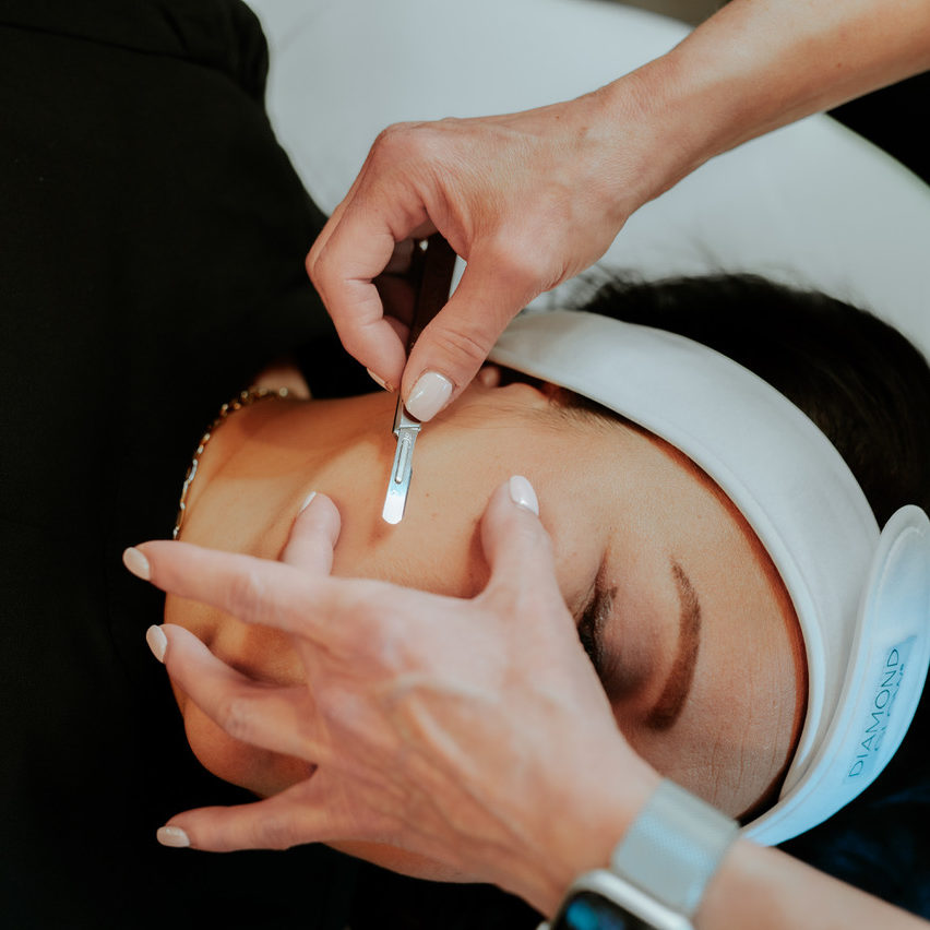Dermaplaning