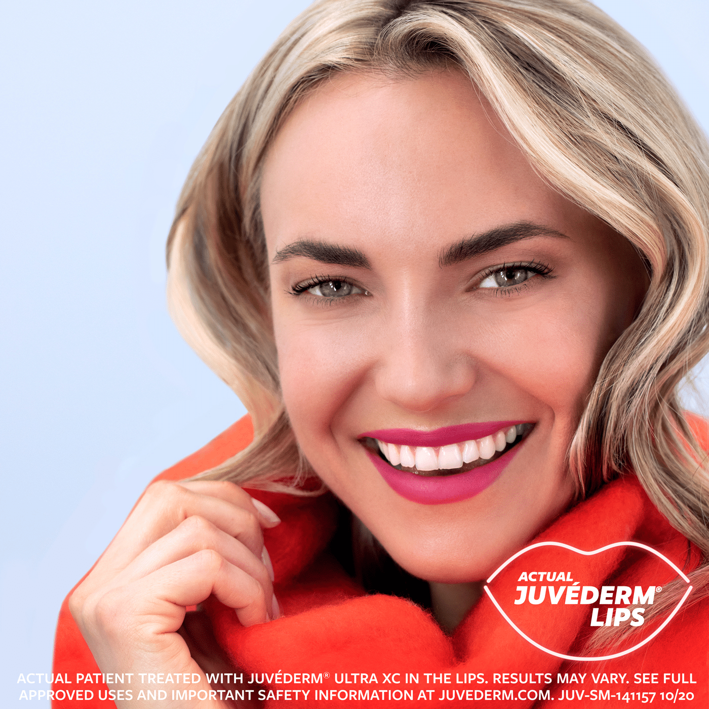 Dermal Fillers Dermal Fillers