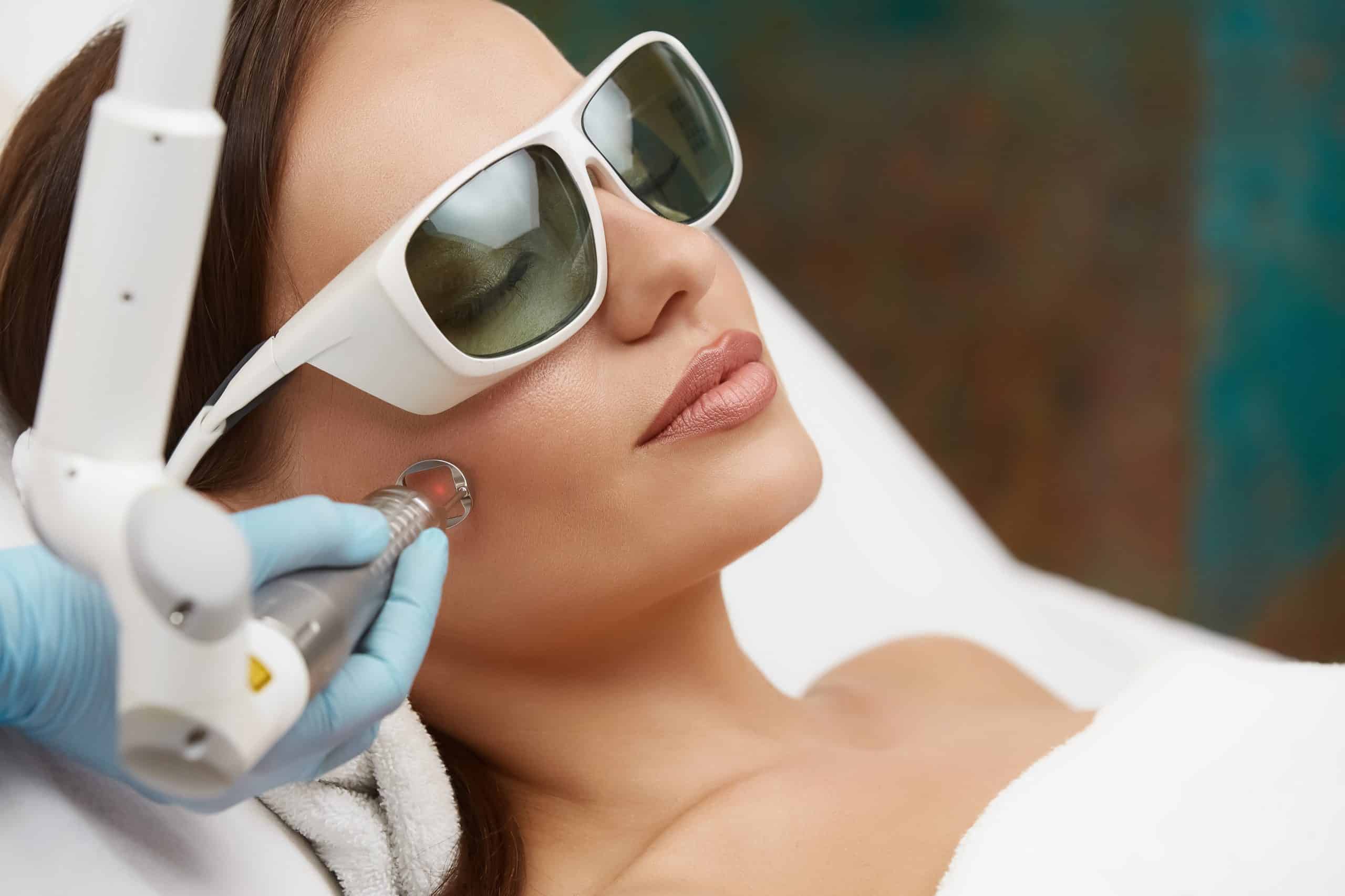 Laser Facial Opus Mini Treatment Your Pathway to Flawless Complexion