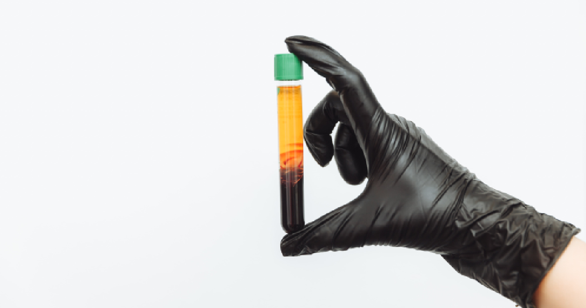 A hand in a black glove holds a test tube with a green cap, showing a liquid separated into yellowish-orange and reddish-brown layers at Ohh Shot in Kenai, AK.