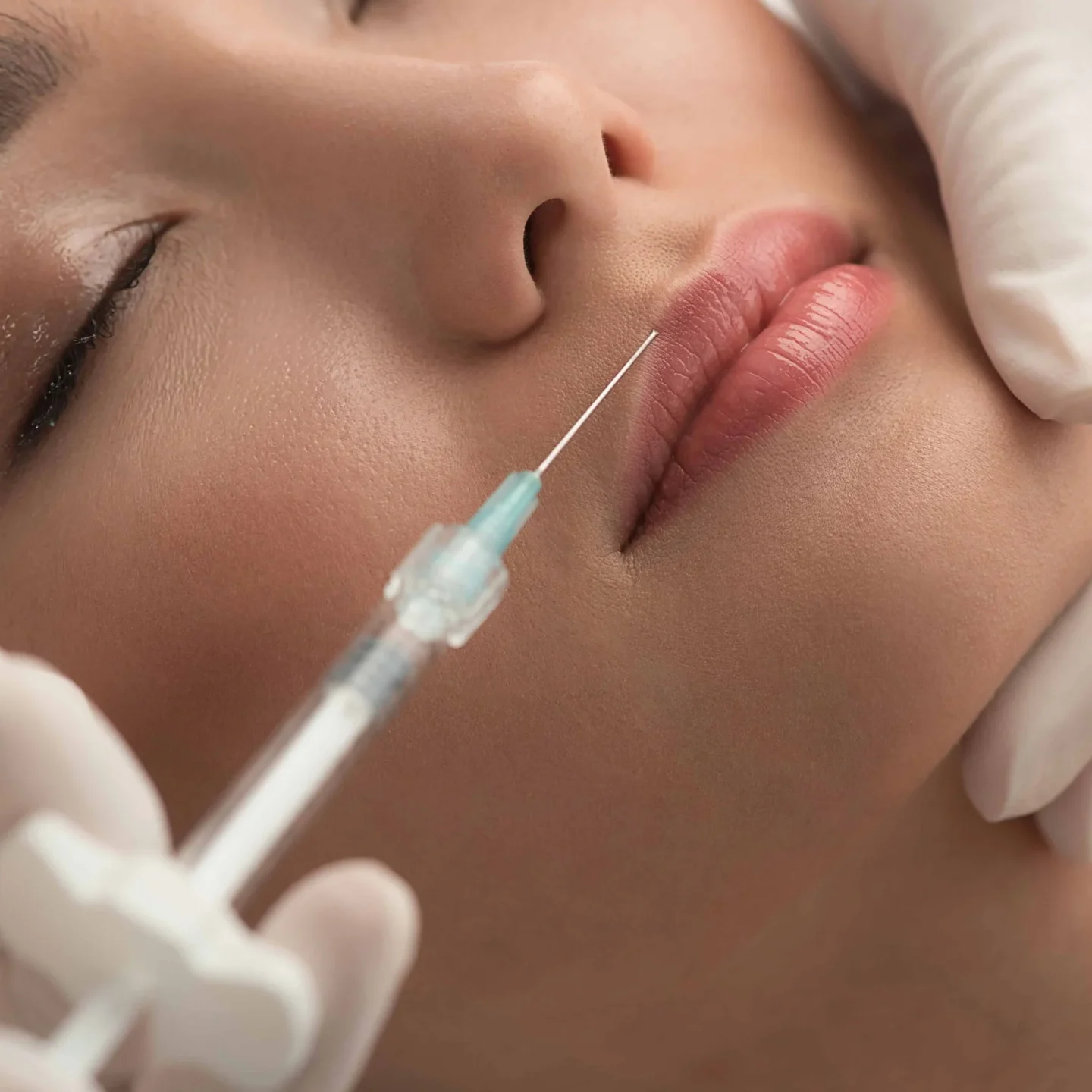 Filler-Dissolver in Alaska | Cheeky Medspa