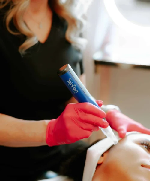 skinpen