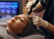 Professional administering microneedling for acne scars on a patient’s forehead using a SkinPen device.