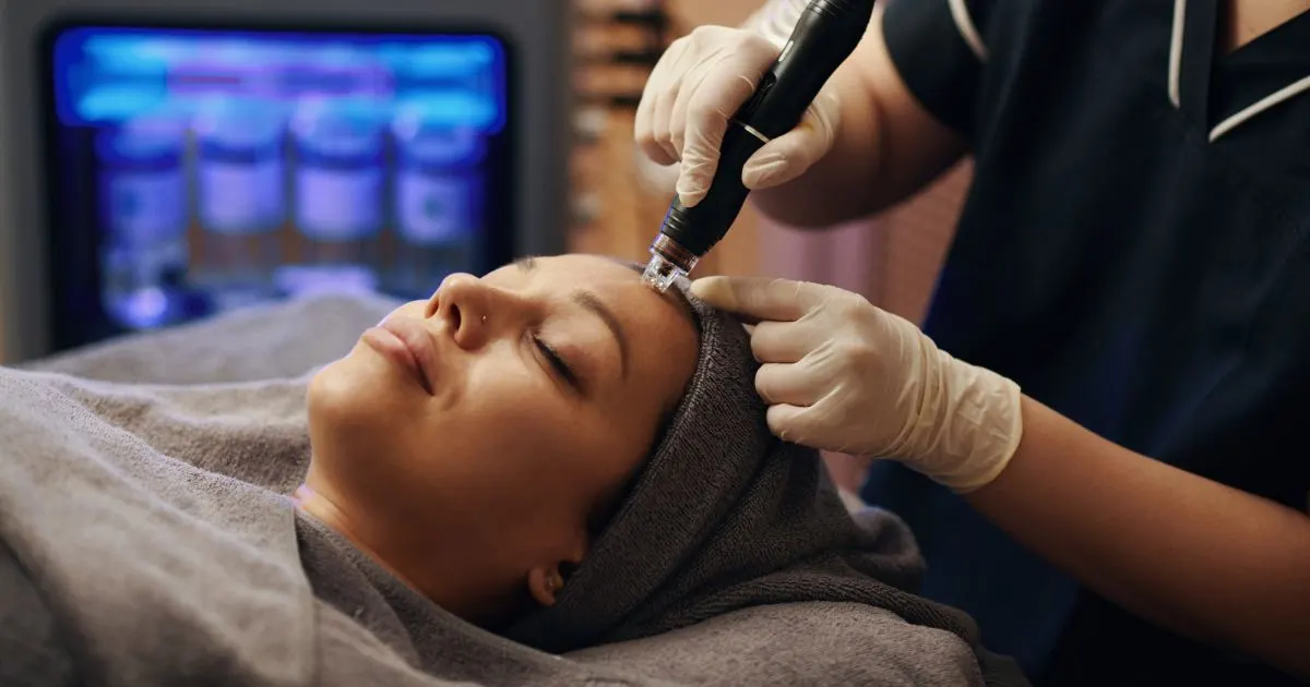 Professional administering microneedling for acne scars on a patient’s forehead using a SkinPen device.
