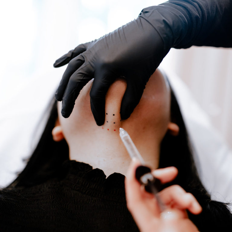 KYBELLA Service page