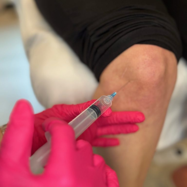 PRP Joint Injections