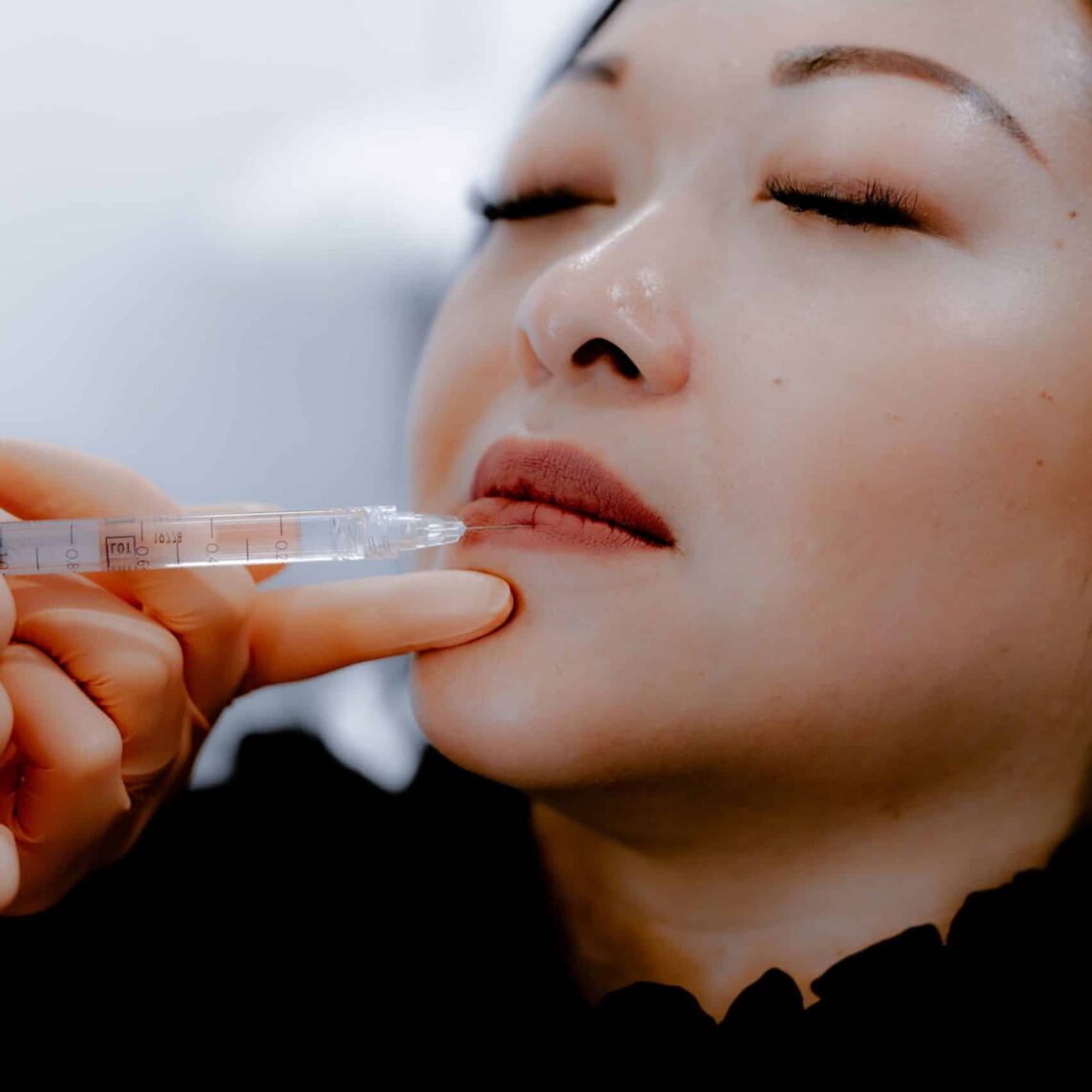 Dermal Fillers Treatments