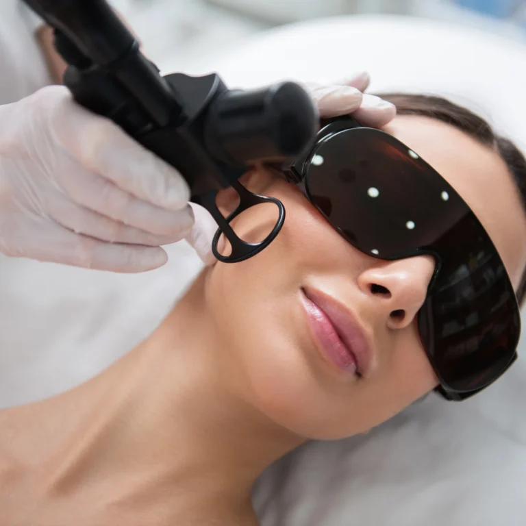 ERBIUM SKIN RESURFACING
